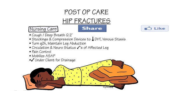 post operative care instruction in surgical wards