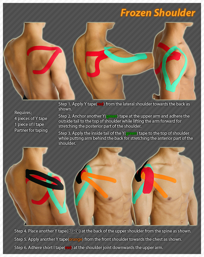 elastoplast kinesiology tape instructions