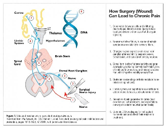 post operative care instruction in surgical wards